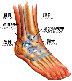 足関節捻挫